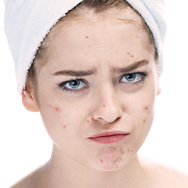 Woman with blemishes